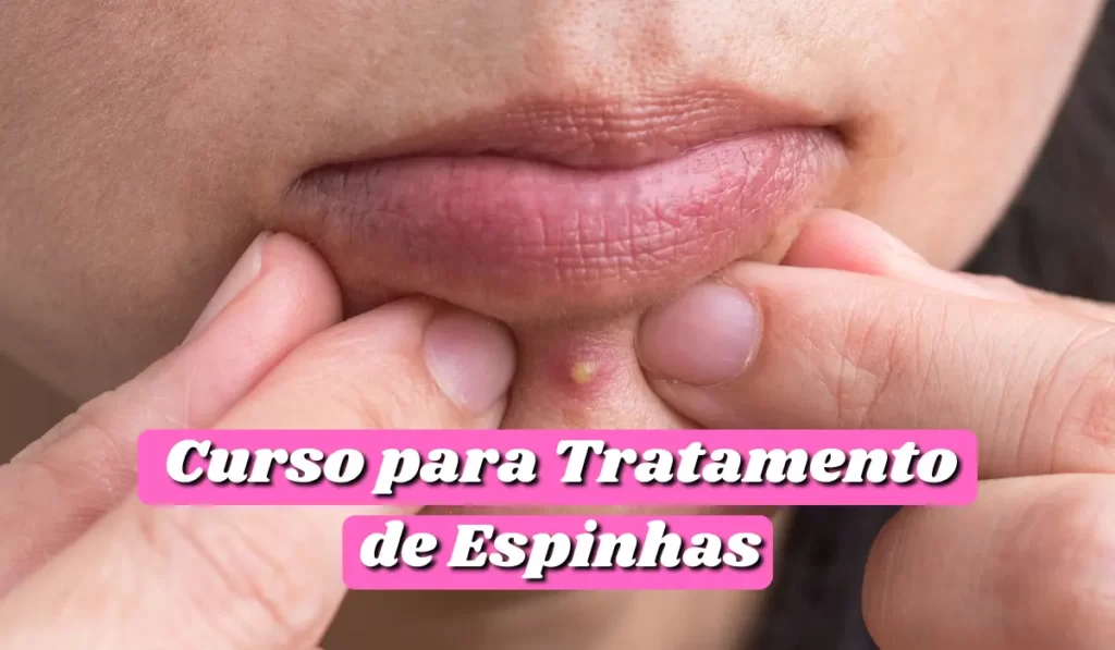 Course for the Treatment of Pimples - Agora Noticias