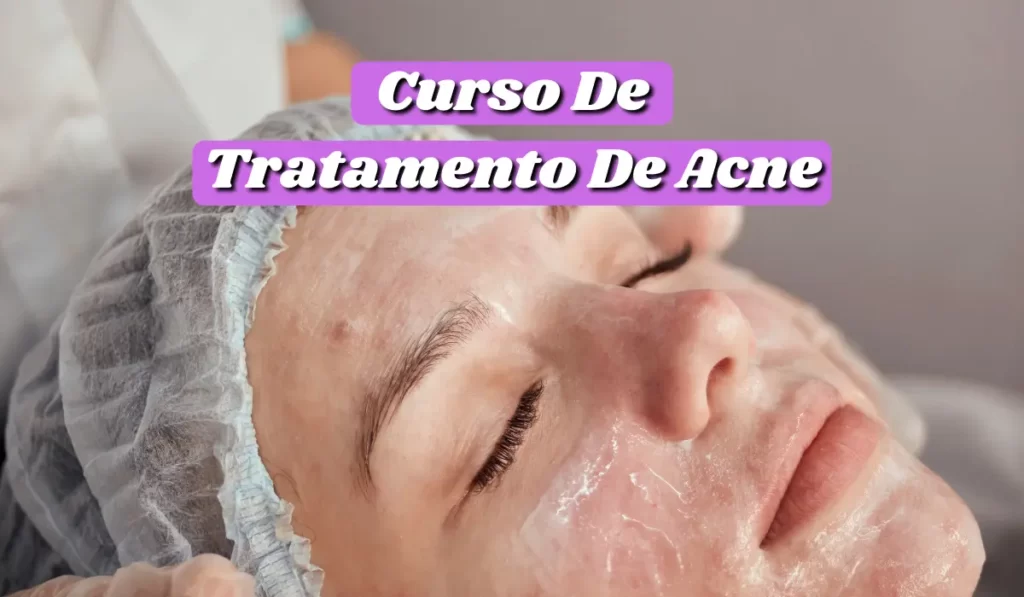 Read more about the article Curso de Tratamento de Acne: Cursos para cuidar da sua pele de forma gratuita e online