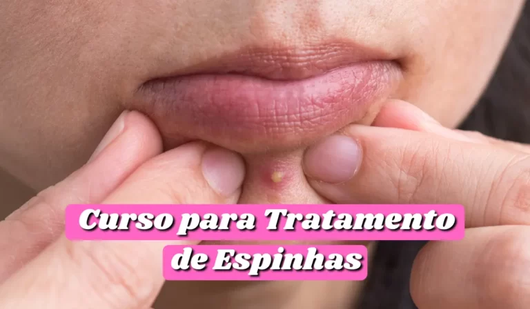 Curso para o Tratamento de Espinhas - Agora Noticias